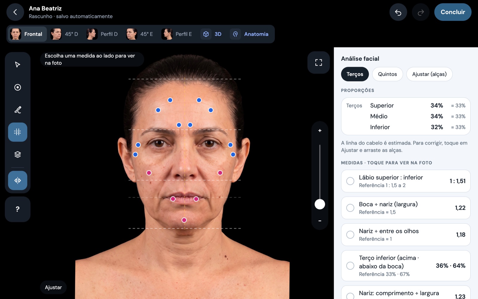 Painel de análise facial com terços e medidas